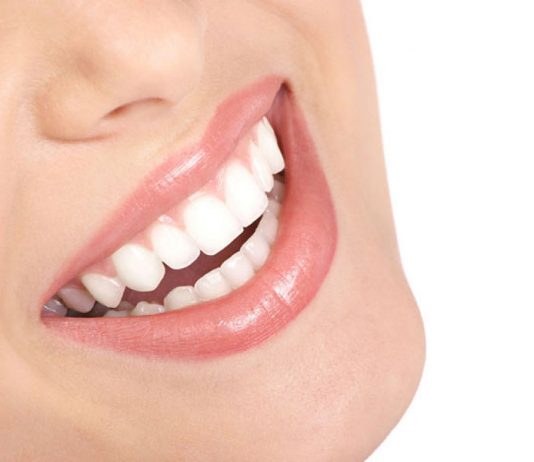 10 alimentos que pueden dañar tu sonrisa