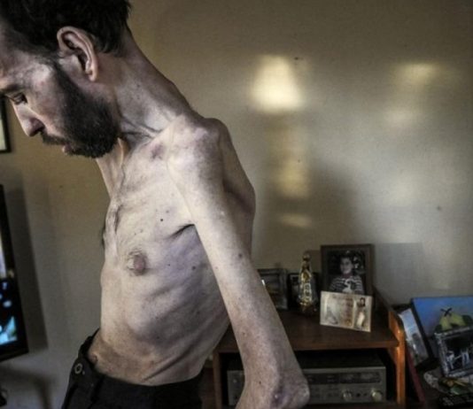 Murió Fabián Tomasi, ícono de la lucha contra los agrotóxicos